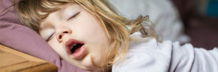 اضافه وزن و چاقی با آپنه انسدادی خواب در کودکان مرتبط است.