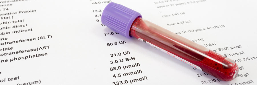 با آزمایش خون میزان پایبندی شما به رژیم غذایی مشخص می‌شود