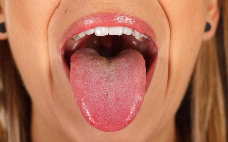 چگونه از سرطان دهان پیشگیری کنید؟